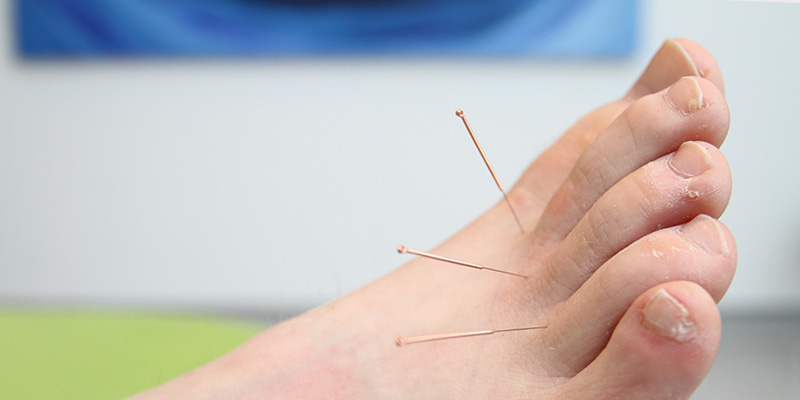 acupuncture feet